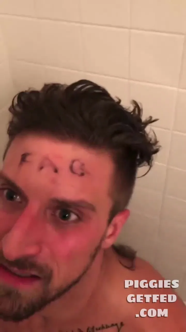 “Just fuckin’ ruined your pretty boy looks”